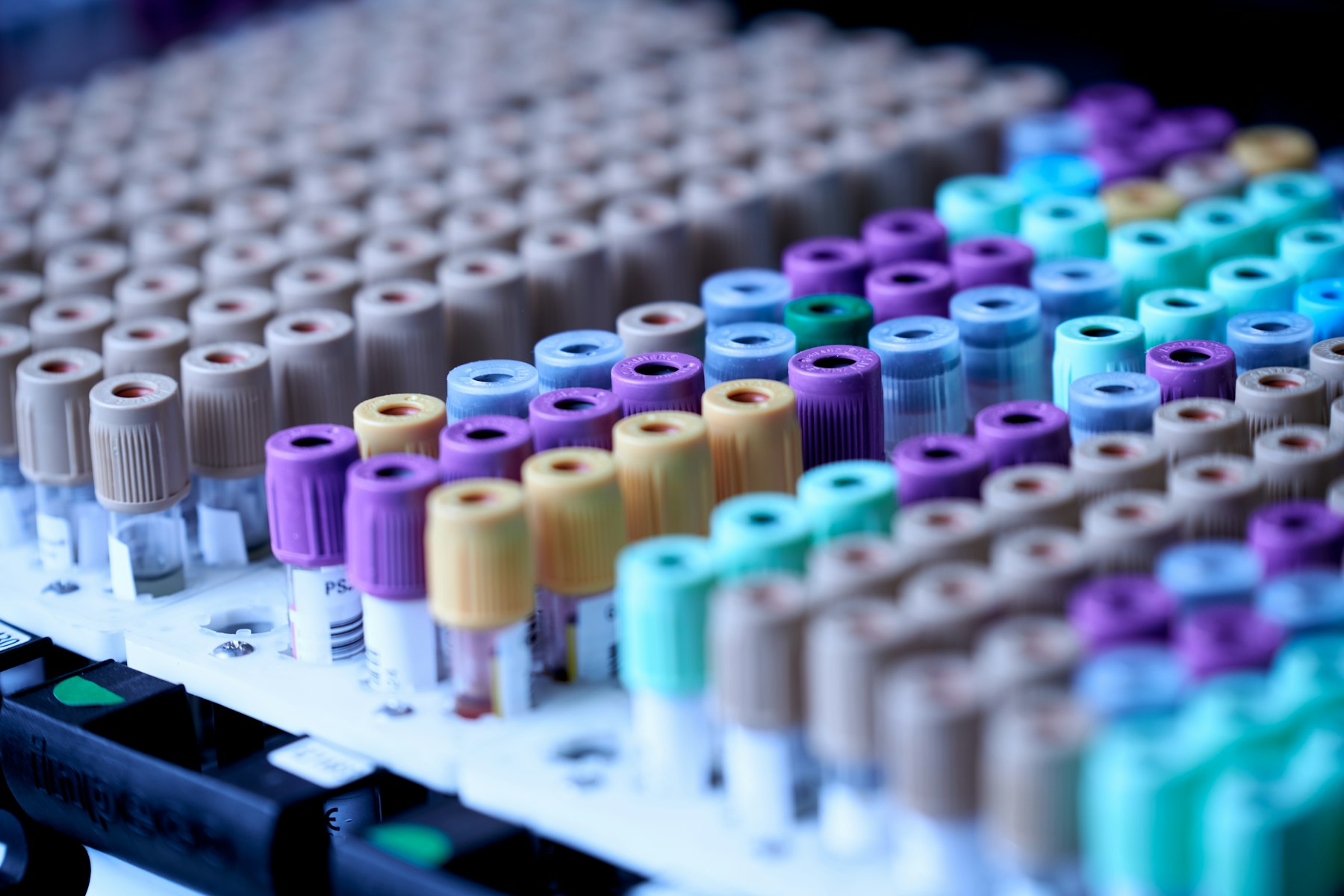 Blood sample tubes in a lab rack